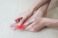 Symptoms and Causes of Gout