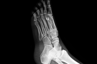 Exploring the Anatomy of the Foot